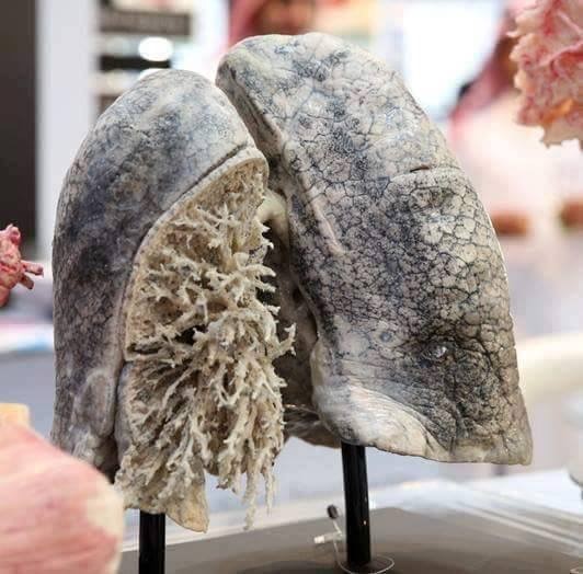 Lungs